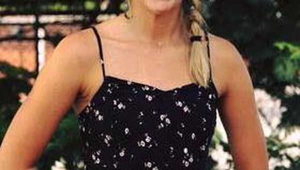 Potret Aimee, Perempuan yang Tubuhnya Sempat Digerogoti Bakteri Pemakan Daging