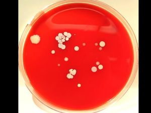 Dianggap Menjijikkan, Foto Ini Dorong Petugas Kesehatan Rajin Cuci Tangan