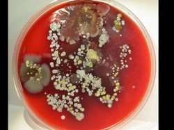 Gambar Ini Bikin Petugas Kesehatan Rajin Cuci Tangan, Bagaimana dengan Anda?