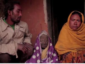 Mengidap Kondisi Langka, Kulit Bocah Ini Menebal Seperti Sisik