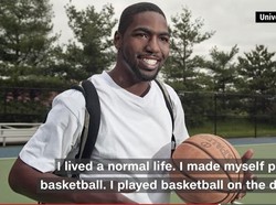 Begini Rasanya Hidup dengan Jantung Buatan