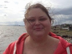 Mirip Gangren, Tapi Penyakit yang Membuat Kulit Menghitam Ini Mematikan