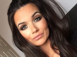 Hendak Putihkan Gigi, Bibir Wanita Ini Malah Kena Luka Bakar Tingkat Tiga