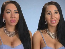 Kembar Identik Ini Ingin Operasi Plastik Demi Payudara yang Sama