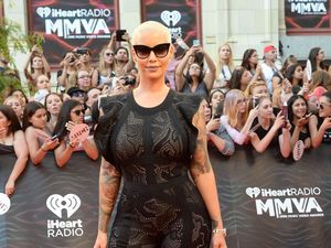 6 Minggu Usai Melahirkan, Amber Rose Langsung Sedot Lemak