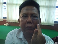 Hakim Pengadilan Agama dan 3 Anaknya Babak Belur Dipukuli Polisi di Aceh