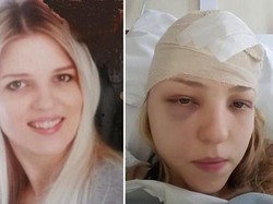 Berusia 27 Tahun, Ibu Muda Ini Sudah Didiagnosis dengan Empat Jenis Kanker