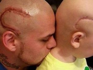 Kisah Ayah yang Bikin Tato Serupa Bekas Luka Operasi Tumor Otak Putranya
