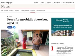 Ariya, Bocah 10 Tahun asal Karawang yang Berbobot 188 Kg Jadi Perhatian Dunia