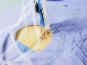 Menaklukkan si Raja Kanker dengan Pisau Nano Menaklukkan si Raja Kanker dengan Pisau Nano
