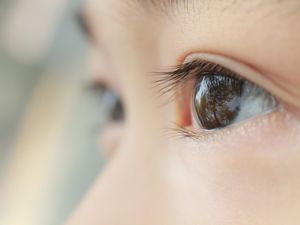 Kena Sinar Laser, Retina Mata Bocah Ini Terbakar Kena Sinar Laser, Retina Mata Bocah Ini Terbakar