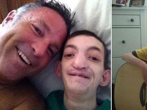 Diprediksi Berumur Pendek, Pengidap Sindrom Langka Ini Rayakan Ultah ke-30