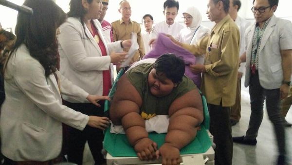 Foto: Dilatih Ade Rai, Begini Transformasi Bocah Obesitas Arya Permana