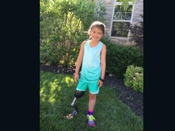 Meski Cuma Punya 1 Kaki, Katie Tetap Semangat dan Akan Ikut Lomba Lari 5 Km