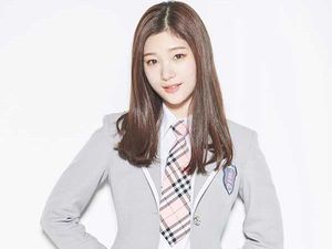 Jung Chaeyeon DIA Malu-malu Akui Pernah Operasi Plastik