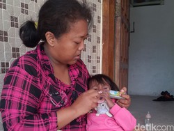 Balita asal Bojonegoro Alami Jantung Bocor sejak Lahir, Butuh Uluran Tangan