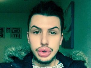 2 Pria Rela Mengubah Wajah Demi Mirip Keluarga Kardashian