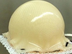 Atasi Radang Sendi, Peneliti Ciptakan Pinggul Hidup Buatan