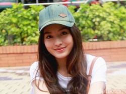 Sibuk Syuting, Natasha Wilona Tetap Perawatan Gigi