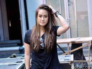 Retak Tulang Selangkangan, Melodya Vanesha Belum Ada Tindakan Medis