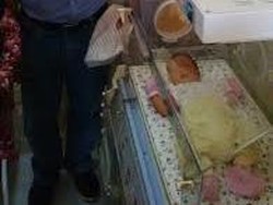 Kondisi Bayi yang Dibuang Stabil Meski Sempat Menguning