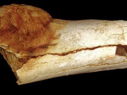 Jejak Kanker Prasejarah Ditemukan pada Fosil Kaki Manusia Purba