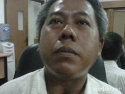 Curhat Pria yang Lehernya Bolong karena Asap Rokok