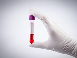Risiko Penggumpalan Darah Bayangi Pasien Virus Corona Risiko Penggumpalan Darah Bayangi Pasien Virus Corona