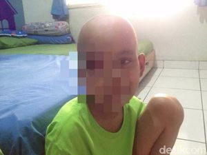 Tubuh Kuning dan Perut Membesar, Anak Ini Ternyata Kena Neuroblastoma