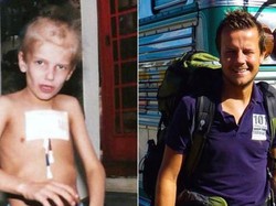 Dua Kali Kena Kanker, Kini Pria Ini Berjuang Atasi Trauma