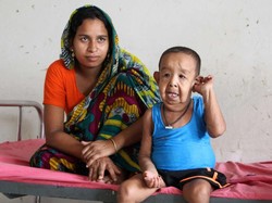 Bikin Penasaran Dokter, Bocah Ini Tubuhnya Terlihat Seperti Orang Tua