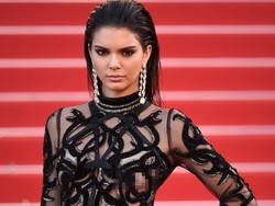 Kendall Jenner Ungkap Perawatan Alami untuk Hilangkan Jerawat
