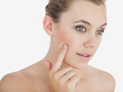 Menghilangkan Bekas Luka Agar Wajah Halus Kembali