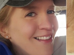 Gara-gara Sindrom Langka, Wanita Ini Puluhan Kali Kena Kanker Kulit