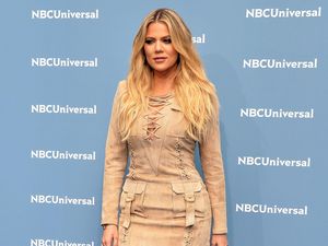 Banyak Tahi Lalat di Tubuh, Khloe Kardashian Takut Kena Kanker Kulit