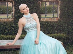 Viral, Foto Model Cantik yang Botak karena Kanker