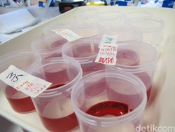 Meski Ada Nyamuk Ber-Wolbachia, PSN dan 3M Tetap Harus Dilakukan