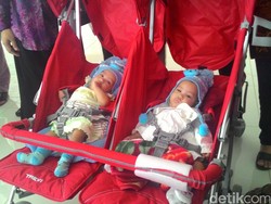 Pasca Operasi Pemisahan, Bayi Kembar Siam Saqira dan Safira Diizinkan Pulang