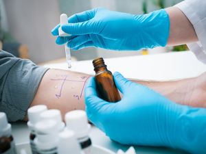 Catat, Ini Pentingnya Melakukan Tes Alergi