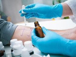 Catat, Ini Pentingnya Melakukan Tes Alergi