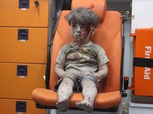 Tatapan Pilu Bocah Korban Perang Suriah