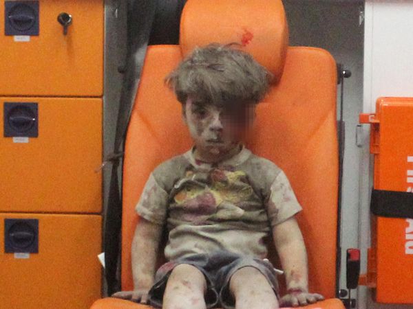 Foto Bocah Suriah di Dalam Ambulans