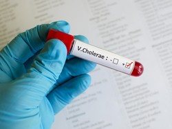 Wabah Kolera Terjadi di Yaman, WHO: Tidak Perlu Panik Berlebihan