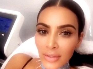 Takut Tangan Keriput, Kim Kardashian Jalani Perawatan Laser