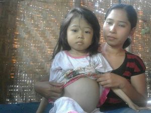 Tak Ada Biaya, Finza Pengidap Talasemia Pilih Berobat ke Paranormal