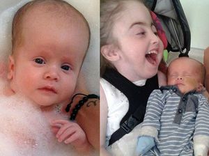 Kisah Reuben yang Sama-sama Alami Cacat Langka Seperti Bibinya