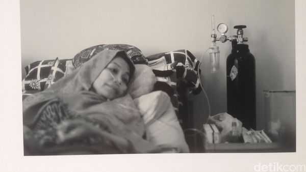 Potret Perjalanan Hidup Para Wanita Berjuang Melawan Kanker Payudara