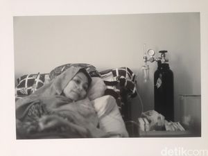 Potret Perjalanan Hidup Para Wanita Berjuang Melawan Kanker Payudara