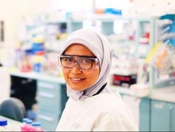 Mahasiswa Indonesia Teliti TB di Australia