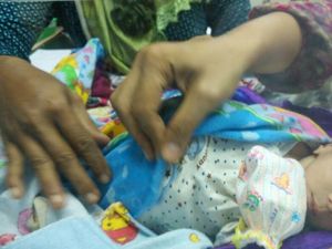 Bayi Lahir Tanpa Anus Dirujuk ke RSU Soetomo Surabaya